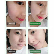 Face Slimming Essence Oil Burning Cream Fat